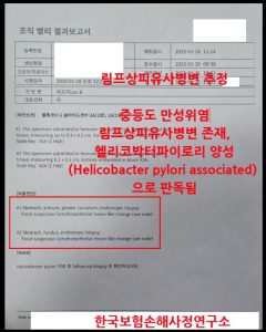 위말트림프종 C88.4