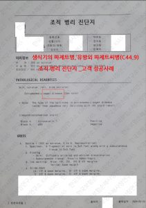 파제트병