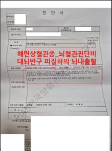 해면상혈관종