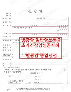 방광제자리암 